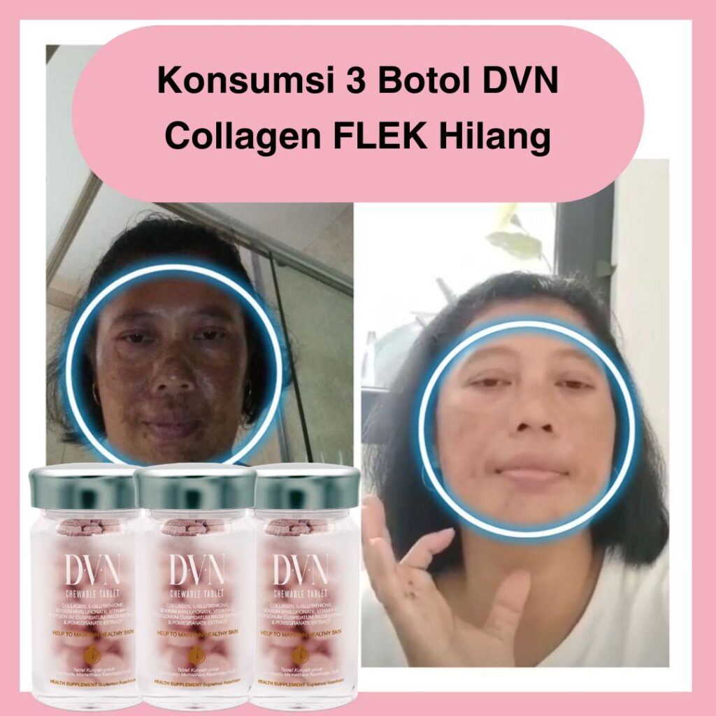 Testimoni (14)