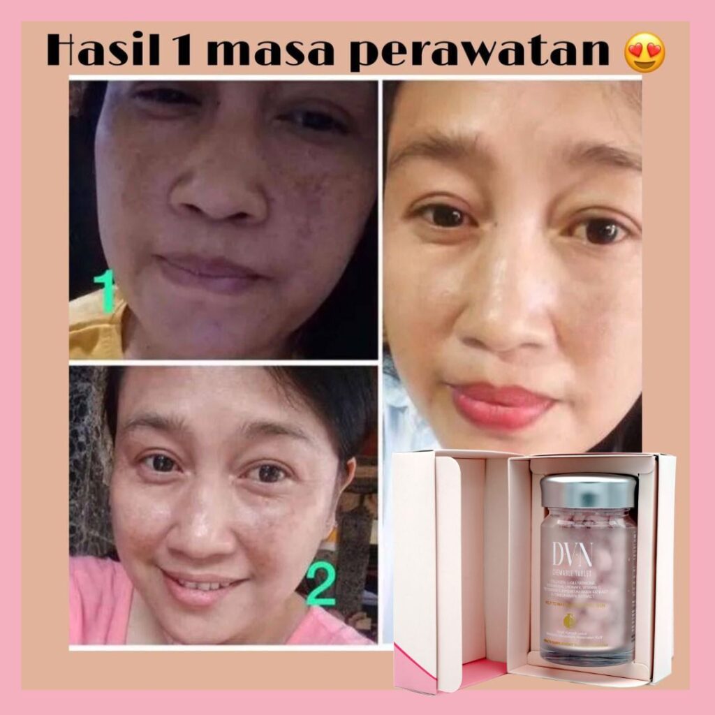 Testimoni (15)