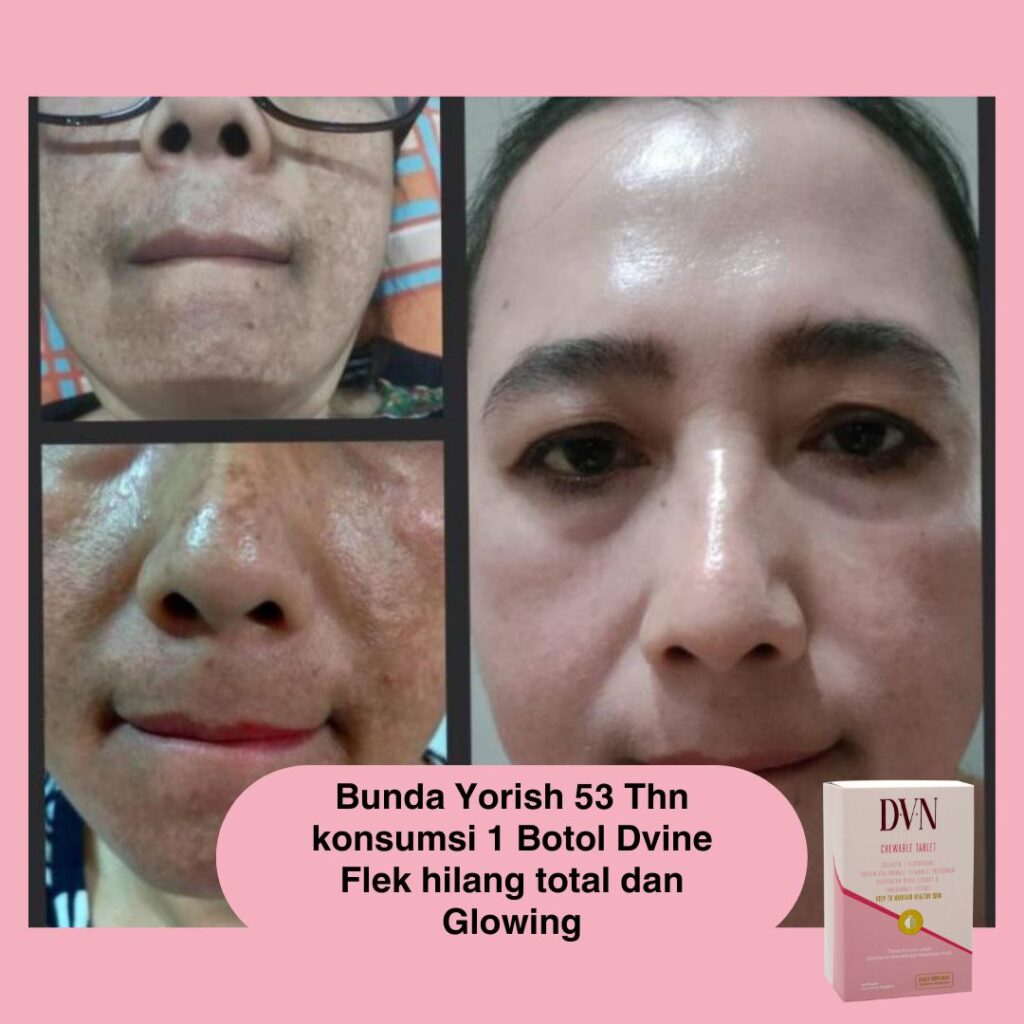 Testimoni (18)